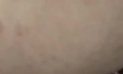 pozisyon almakta zorlanan kadına yardımcı oluyor pozisyon almakta zorlanan kadına yardımcı oluyor